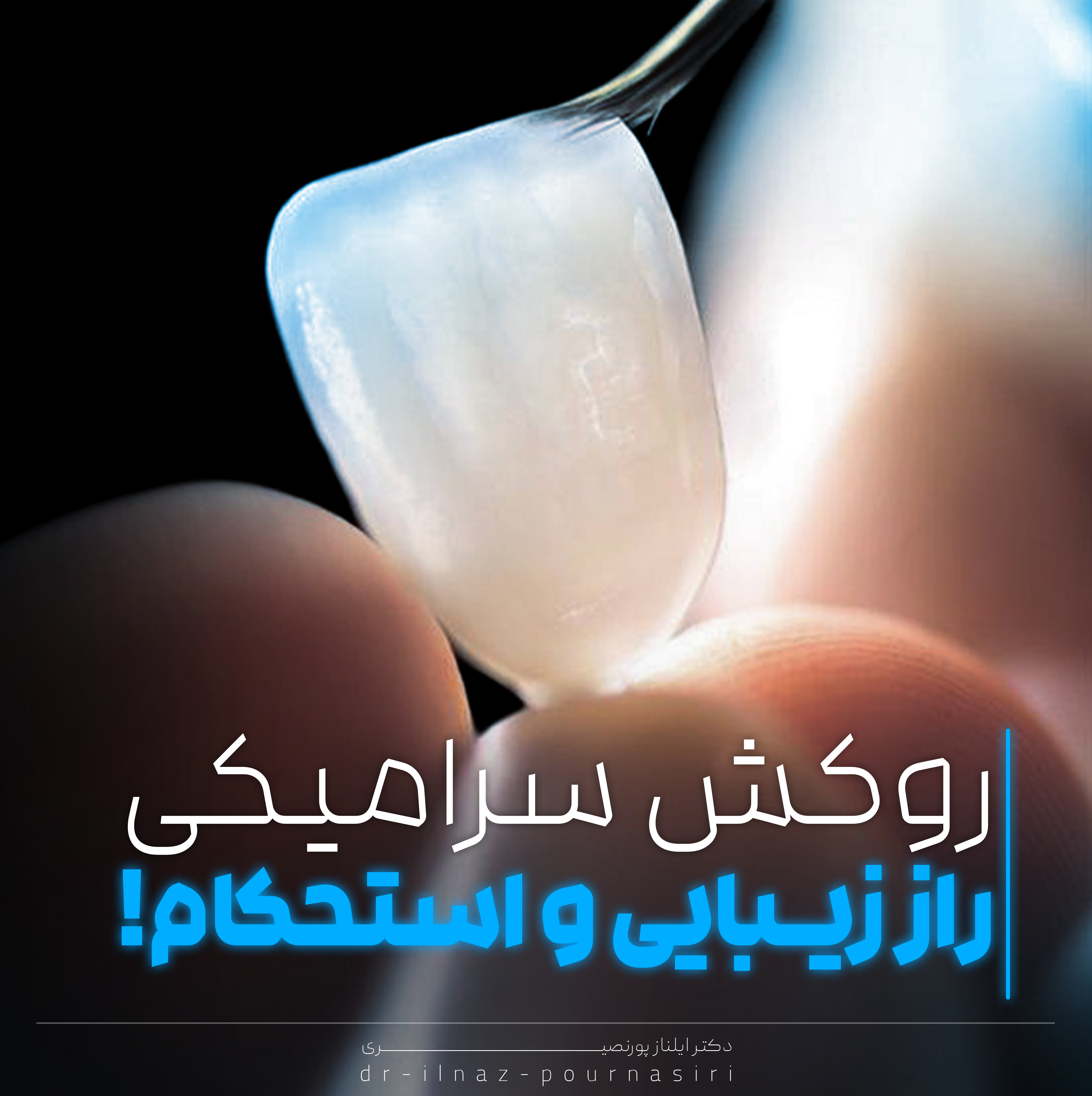 لمینت لبه شیشه ای